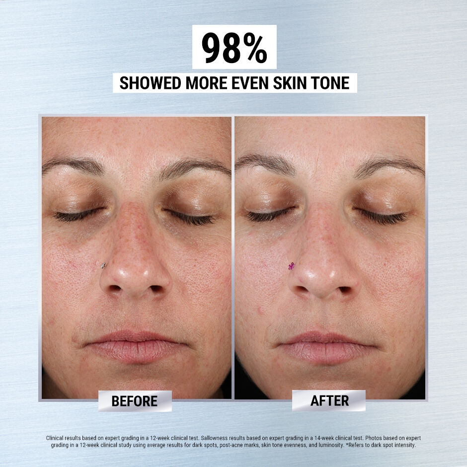 Kiehl's clearly corrective dark store spot solution